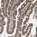 Immunohistochemical staining of human duodenum shows moderate cytoplasmic positivity in glandular cells.