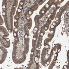 Immunohistochemical staining of human duodenum shows moderate cytoplasmic positivity in glandular cells.