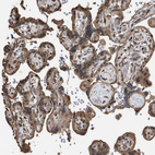 Immunohistochemical staining of human placenta shows moderate cytoplasmic positivity in trophoblastic cells.