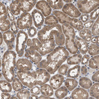 Immunohistochemical staining of human kidney shows moderate cytoplasmic positivity in cells in tubules.