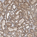 Immunohistochemical staining of human kidney shows moderate cytoplasmic positivity in cells in tubules.