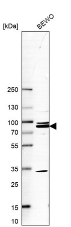 Western blot analysis in human cell line BEWO.