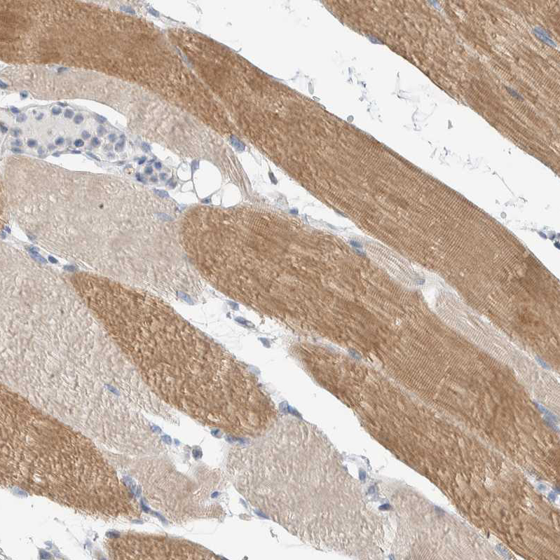 Anti-ENGASE Antibody