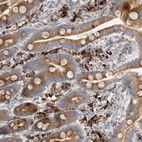 Immunohistochemical staining of human duodenum shows moderate cytoplasmic positivity in glandular cells and lymphoid cells.