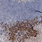 Immunohistochemical staining of human tonsil shows strong cytoplasmic-membranous positivity in non-germinal center cells.