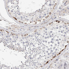 Immunohistochemical staining of human testis shows moderate cytoplasmic positivity in spermatogonia cells.
