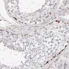 Immunohistochemical staining of human testis shows moderate cytoplasmic positivity in spermatogonia cells.