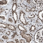 Immunohistochemical staining of human kidney shows strong nuclear positivity in cells in tubules.