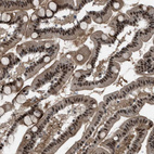 Immunohistochemical staining of human small intestine shows strong nuclear positivity in glandular cells.
