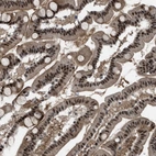 Immunohistochemical staining of human small intestine shows strong nuclear positivity in glandular cells.