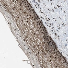 Immunohistochemical staining of human cervix, uterine shows strong nuclear positivity in squamous epithelial cells.