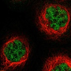 Immunofluorescent staining of human cell line A-431 shows localization to nucleoplasm.