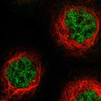 Immunofluorescent staining of human cell line A-431 shows localization to nucleoplasm.