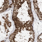 Anti-NPLOC4 Antibody