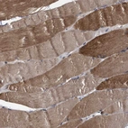 Immunohistochemical staining of human skeletal muscle shows moderate to strong cytoplasmic positivity in myocytes.