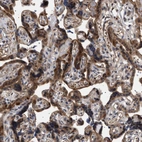 Immunohistochemical staining of human placenta shows moderate granular cytoplasmic positivity in trophoblastic cells.