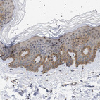 Immunohistochemical staining of human skin shows weak to moderate cytoplasmic positivity in squamous epithelial cells.