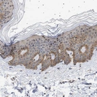 Immunohistochemical staining of human skin shows weak to moderate cytoplasmic positivity in squamous epithelial cells.