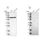 Western blot analysis using Anti-NPLOC4 antibody HPA021560 (A) shows similar pattern to independent antibody HPA023295 (B).