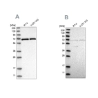 Western blot analysis using Anti-NPLOC4 antibody HPA021560 (A) shows similar pattern to independent antibody HPA023295 (B).