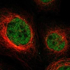 Immunofluorescent staining of human cell line A-431 shows localization to nucleoplasm.