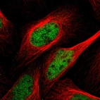 Immunofluorescent staining of human cell line U-2 OS shows localization to nucleoplasm.