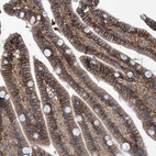 Immunohistochemical staining of human duodenum shows strong membranous positivity in glandular cells.