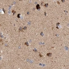 Immunohistochemical staining of human cerebral cortex using Anti-SCO1 antibody HPA021565.
