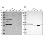 Western blot analysis using Anti-SCO1 antibody HPA021565 (A) shows similar pattern to independent antibody HPA021579 (B).