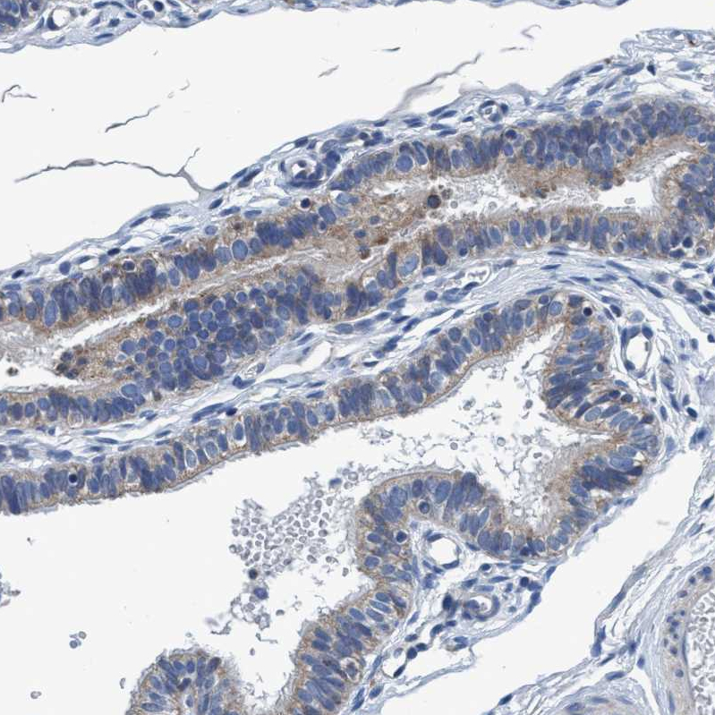 Anti-ANKFN1 Antibody