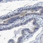 Anti-ANKFN1 Antibody
