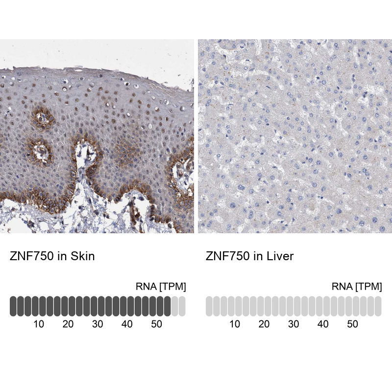 Anti-ZNF750 Antibody