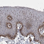Immunohistochemical staining of human skin shows moderate nuclear and cytoplasmic/membranous positivity in squamous epithelial cells.