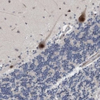Immunohistochemical staining of human cerebellum shows strong nuclear positivity in Purkinje cells.