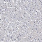 Immunohistochemical staining of human liver shows no positivity in hepatocytes as expected.