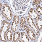 Anti-TRIM65 Antibody