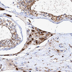 Immunohistochemical staining of human testis shows strong cytoplasmic granular positivity in Leydig cells.
