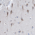 Immunohistochemical staining of human cerebral cortex shows strong cytoplasmic granular positivity in neurons.