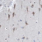 Immunohistochemical staining of human cerebral cortex shows strong cytoplasmic granular positivity in neurons.
