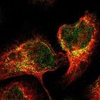 Immunofluorescent staining of human cell line U-2 OS shows localization to nucleoplasm & vesicles.