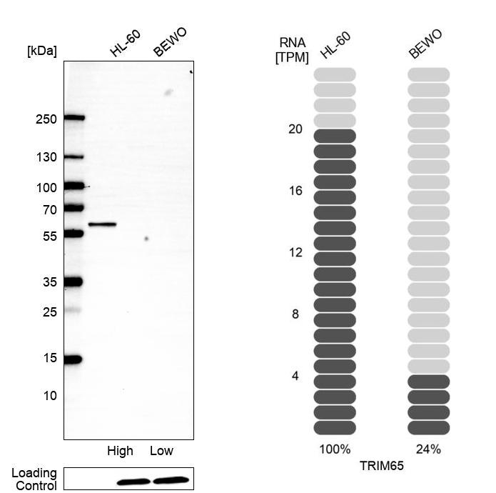 Anti-TRIM65 Antibody