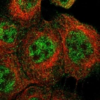 Immunofluorescent staining of human cell line A-431 shows localization to nucleoplasm & cytosol.
