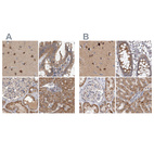 Anti-SCO1 Antibody