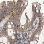Immunohistochemical staining of human colon using Anti-SCO1 antibody HPA021579.