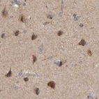 Immunohistochemical staining of human cerebral cortex using Anti-SCO1 antibody HPA021579.
