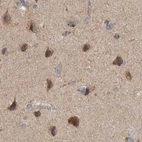 Immunohistochemical staining of human cerebral cortex using Anti-SCO1 antibody HPA021579.