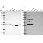 Anti-SCO1 Antibody