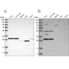 Western blot analysis using Anti-SCO1 antibody HPA021579 (A) shows similar pattern to independent antibody HPA021565 (B).