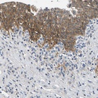 Anti-NT5C Antibody