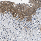 Anti-NT5C Antibody